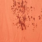 血液のついたワンピース