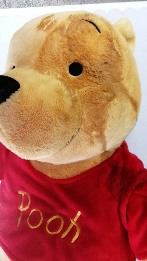 顔にゴアゴアのシミ